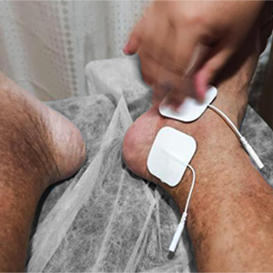 Transcutaneous Electrical Nerve Stimulation or TENS